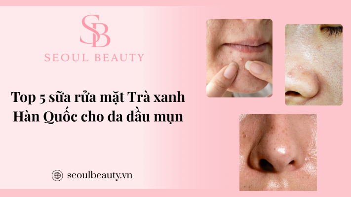 Top 5 sữa rửa mặt trà xanh Hàn Quốc cho da dầu mụn