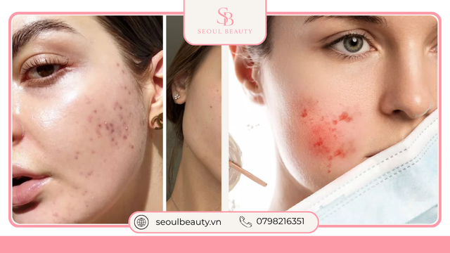 Những sai lầm khi đắp mặt nạ dưỡng da đúng cách
