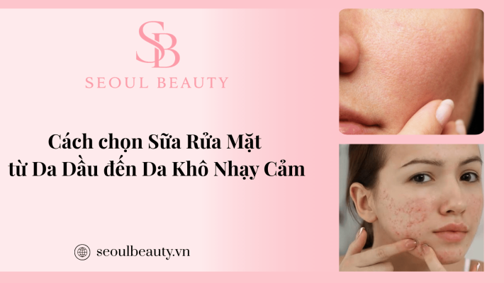 Cách chọn Sữa Rửa Mặt từ Da Dầu đến Da Khô Nhạy Cảm